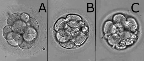 Qualidade dos embriões