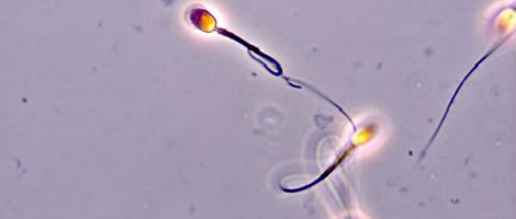 Espermatozóides