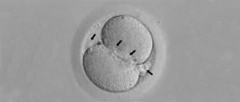 Embrião de Grau II