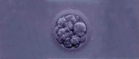 Embrião de grau IV