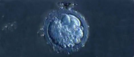 Embrião de grau V