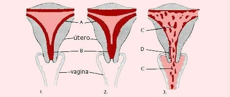Coágulos na menstruação