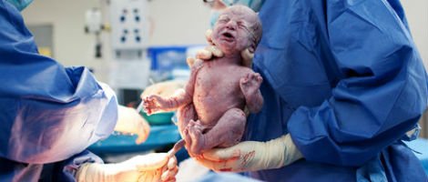 Nascimento de um bebé