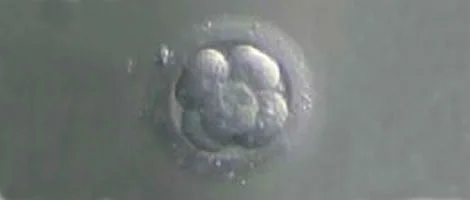 Qualidade embrionária