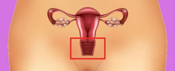 Esterilidade Feminina devido a um Factor Cervical