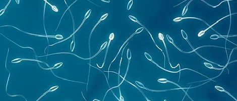 Espermatozóides de Doador